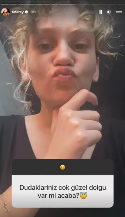 Ünlü oyuncudan estetik cevabı!